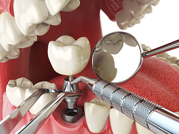 Best Mobile Emergency Dentist in Stone Mountain, GA
